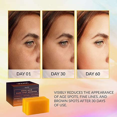 VALITIC Kojic Acid Dark Spot Remover Soap